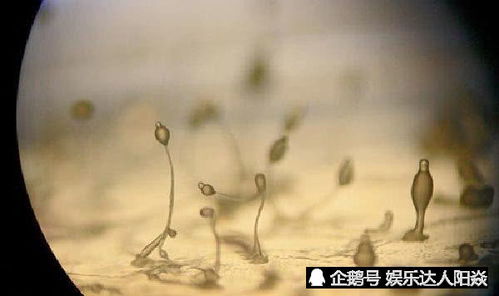 家里養(yǎng)花有霉菌會(huì)致癌