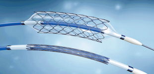 威海創(chuàng)新創(chuàng)業(yè)基地心臟支架