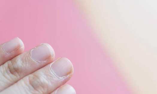 手起倒刺吃什么維生素,手指上長倒刺是因?yàn)槿狈S生素嗎圖7