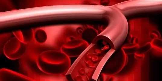 o型血為什么是萬(wàn)能血,o型血為什么是萬(wàn)能血圖3