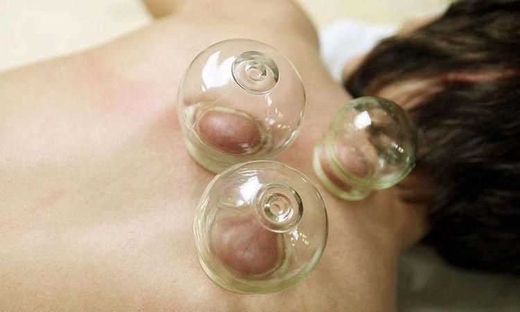 拔完火罐之后什么時(shí)候可以洗澡