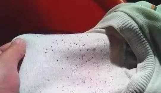 為什么衣服會(huì)發(fā)霉，為什么衣服沒(méi)穿多久就發(fā)霉？圖4