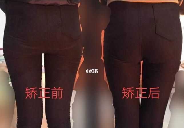 假胯寬的人應該如何鍛煉和矯正走路姿勢視頻