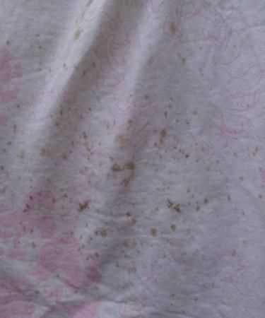 床單被子發(fā)霉怎么處理妙招