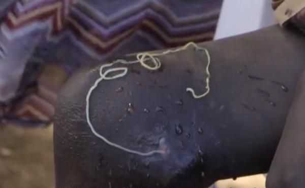 小紅沙蚤是什么