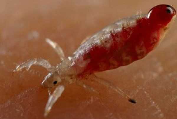 陰虱會在被子存活,陰虱在床單上能活多久圖2