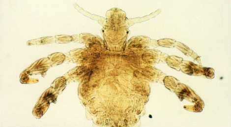 陰虱會在被子存活,陰虱在床單上能活多久