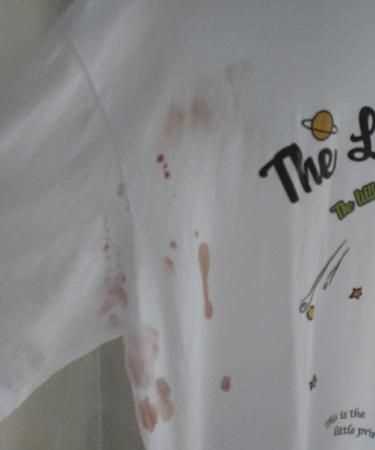 血弄到衣服上妙招去除