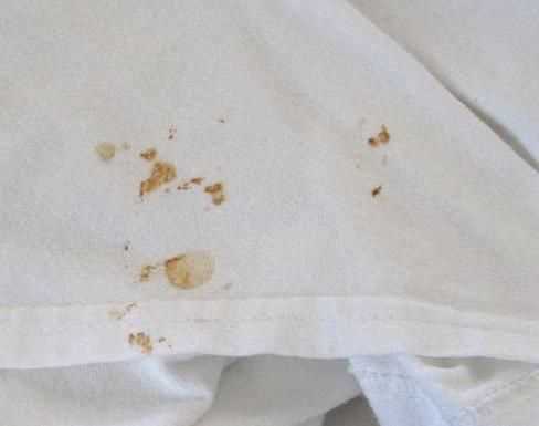 如何去掉衣服上的血跡?