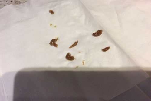 為什么會有蟑螂卵