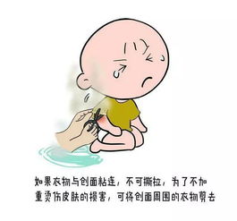 如何預(yù)防燙傷安全知識(shí)幼兒園