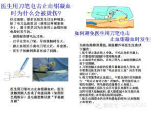 手術(shù)室護(hù)理安全知識(shí)