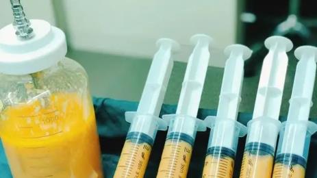 抽脂肪20斤一般多少錢