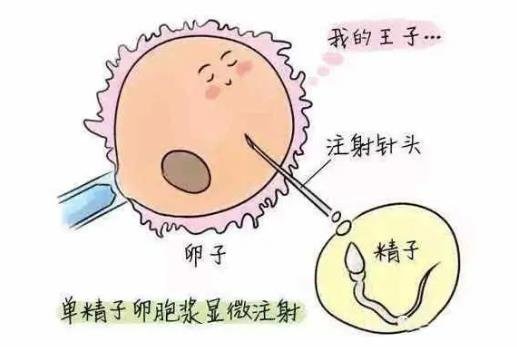 試管嬰兒怎么做的全過程