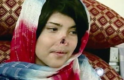 割鼻子的美人典故