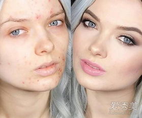 粉刺,句子,能量