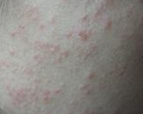 中醫(yī)面部病色有哪些方法有哪些