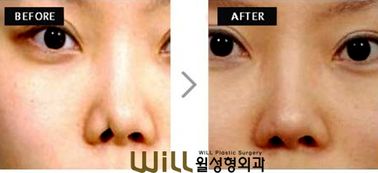 合肥小孩看鼻子醫(yī)院有哪些方法