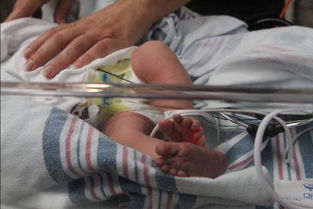 醫(yī)院防止丟新生兒都有哪些好的方法