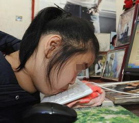 治癱瘓的方法有哪些