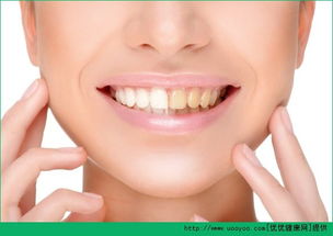 檸檬美白牙齒的正確方法有哪些