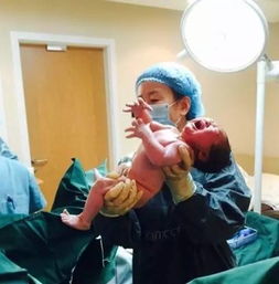 哪些方法能促進(jìn)分娩發(fā)動