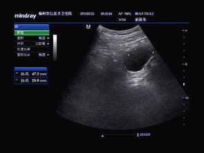 人流最快的恢復(fù)方法有哪些