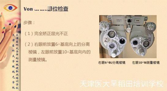 檢查眼位的方法有哪些