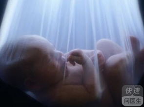 羊水過多的診斷檢查方法有哪些