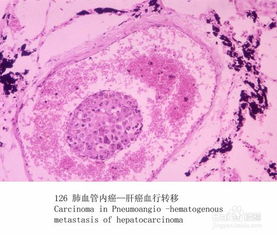病理的研究方法有哪些