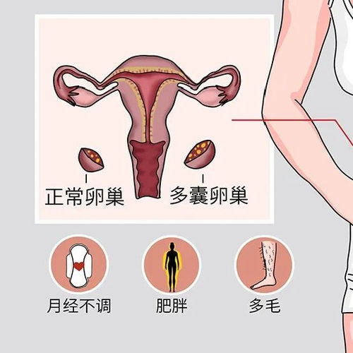 不孕不育的癥狀及治療方法有哪些