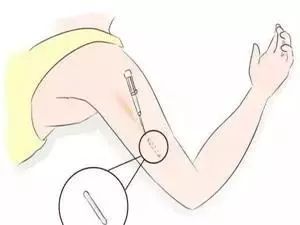 40歲以上避孕方法有哪些