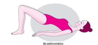 盆底肌松弛鍛煉的方法有哪些