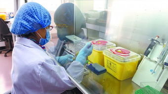 艾滋病抗體快速檢測(cè)方法有哪些