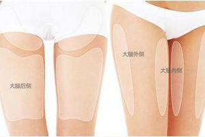 吸脂手術(shù)好方法有哪些方法有哪些