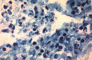 結(jié)核分枝桿菌的染色方法有哪些