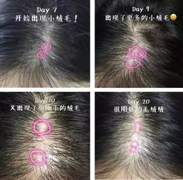 防脫發(fā)好方法有哪些