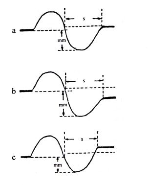 測量的標準方法有哪些