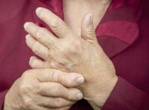 小兒關(guān)節(jié)炎方法有哪些