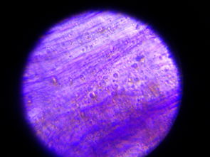 微生物顯微觀察時(shí)有哪些制片方法