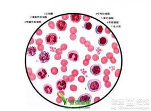 得了再障用哪些方法能治好