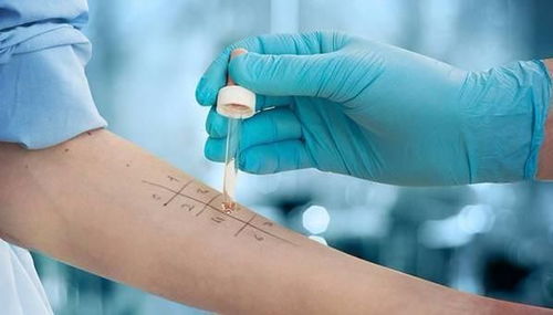 測(cè)過(guò)敏原的方法有哪些