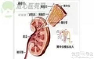 膜性腎病的治療方法有哪些