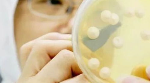 常用菌種保藏方法有哪些