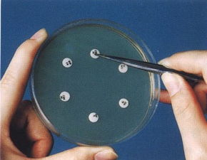 進行藥敏實驗有哪些方法