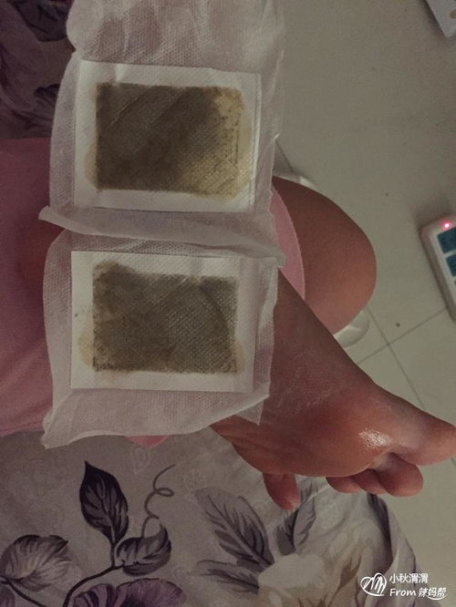 排毒祛濕的好方法有哪些