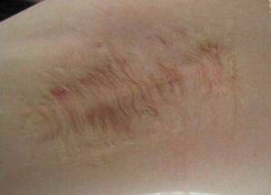 關(guān)于狐臭的詩句