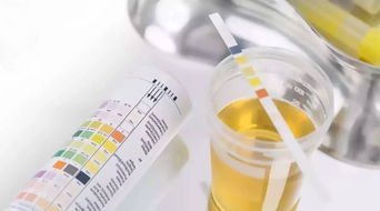 正確留取檢驗標本須知(正確留取檢驗標本須知)