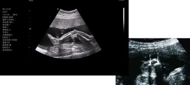 超聲科普小知識(shí)(科普小知識(shí)作文500字)