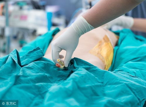 護(hù)理操作導(dǎo)尿注意事項,基礎(chǔ)護(hù)理男性導(dǎo)尿注意事項,導(dǎo)尿的護(hù)理措施和注意事項